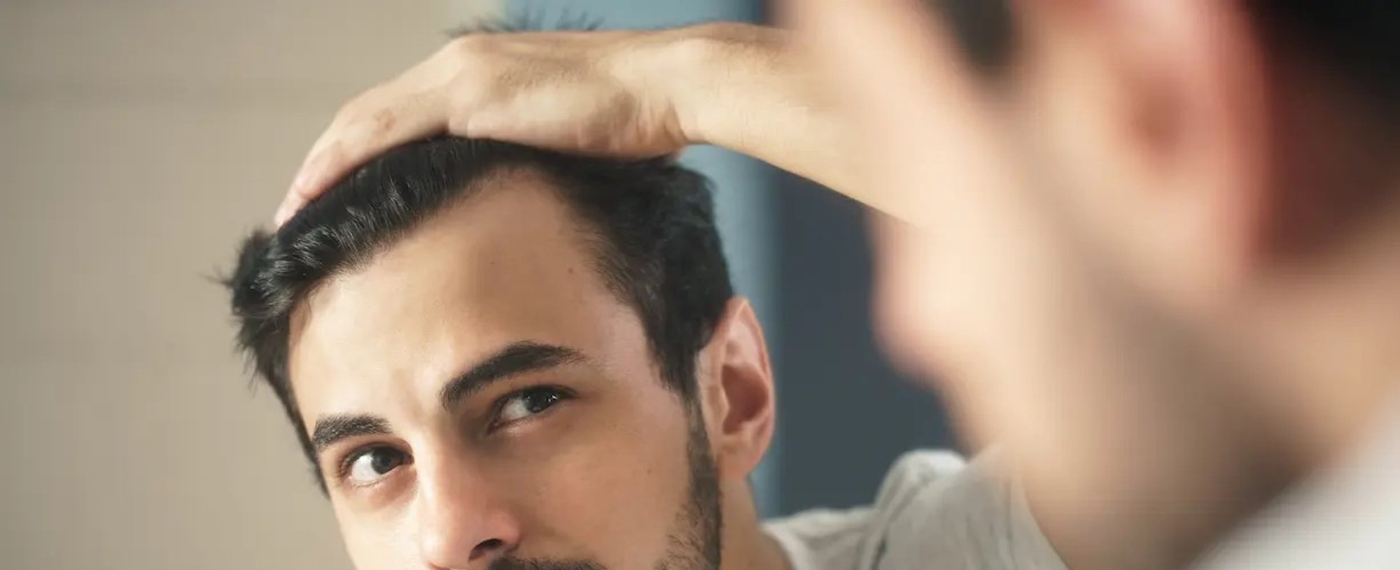Alopecia