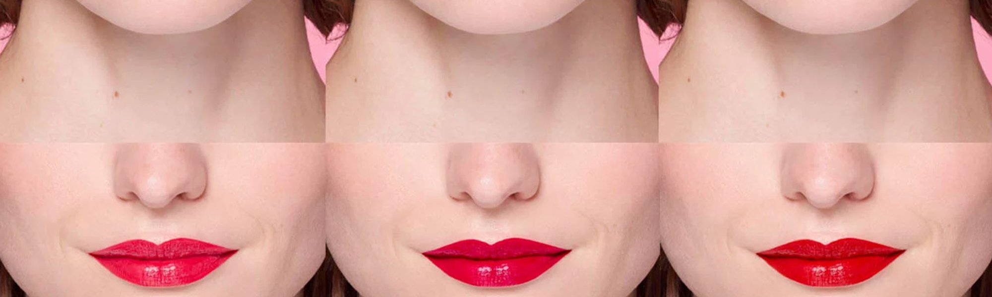 LipliftApertura