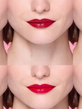 LipliftApertura