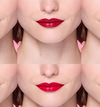 LipliftApertura