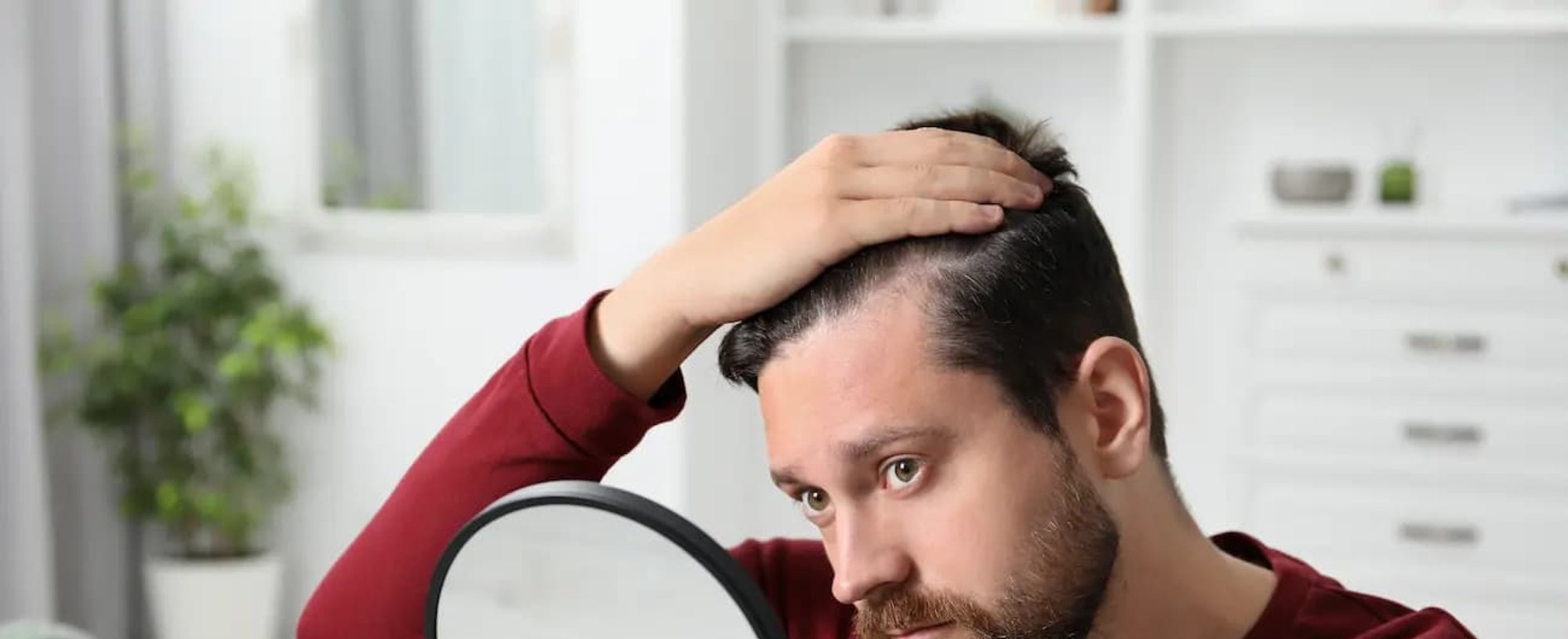 Alopecia Androgenetica