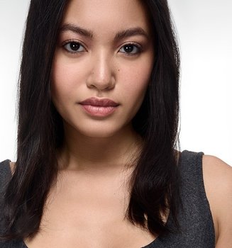 251125 Oap Elvive Collagen Lifter Before After Abegail Straight Stage 2000x815 Dmi Website