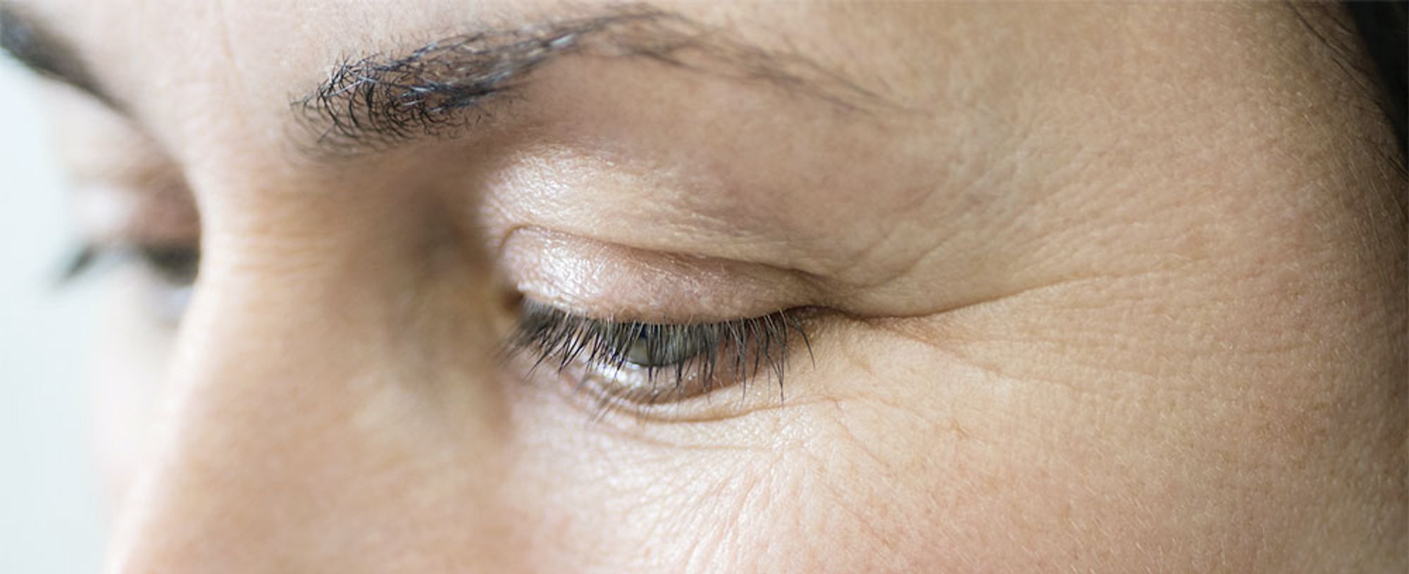 arrugas ojos disimular patas gallo