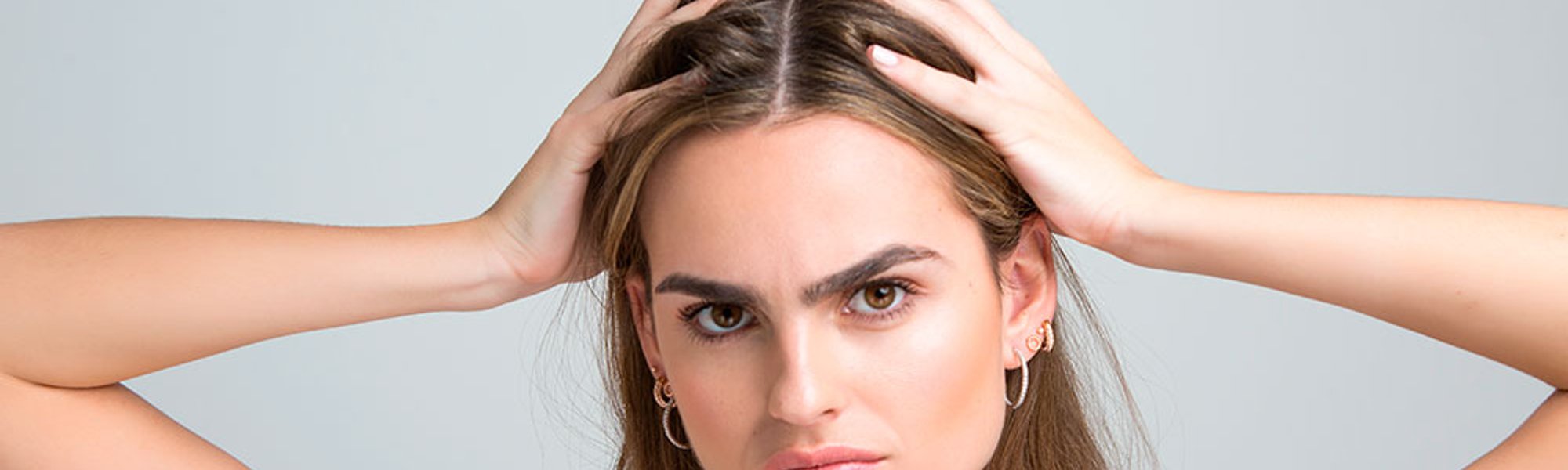 que es caspa por que aparece