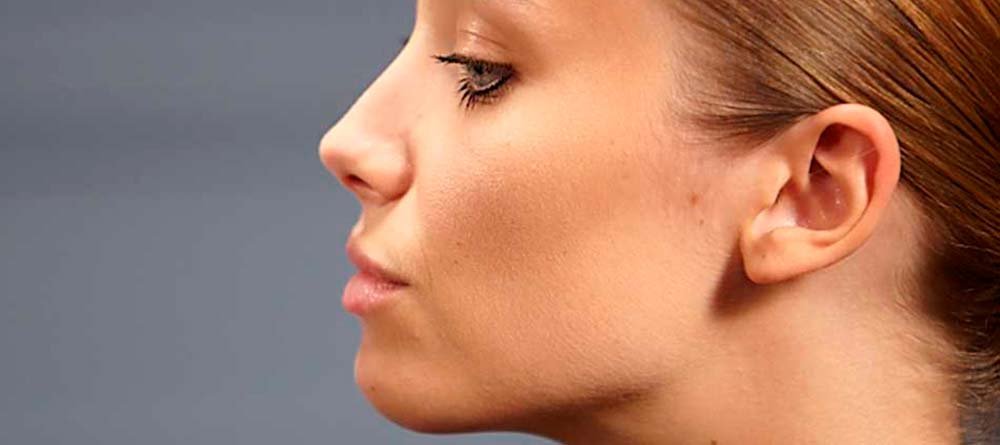 remedios acne cremas maquillajes oilfree