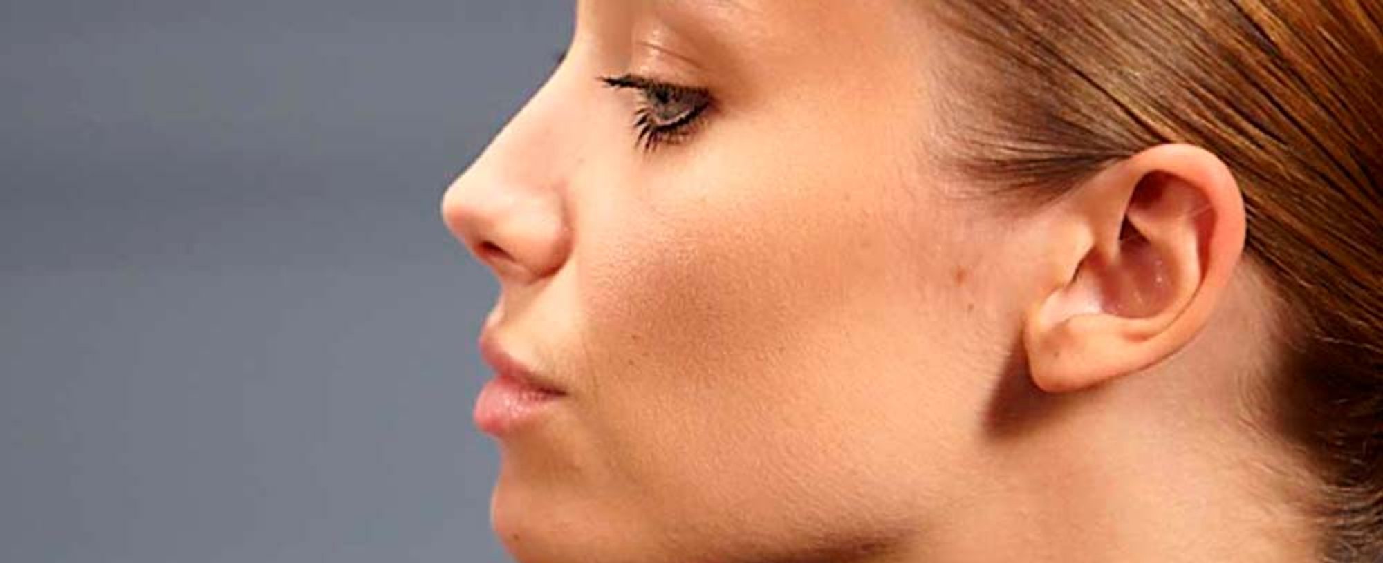 remedios acne cremas maquillajes oilfree