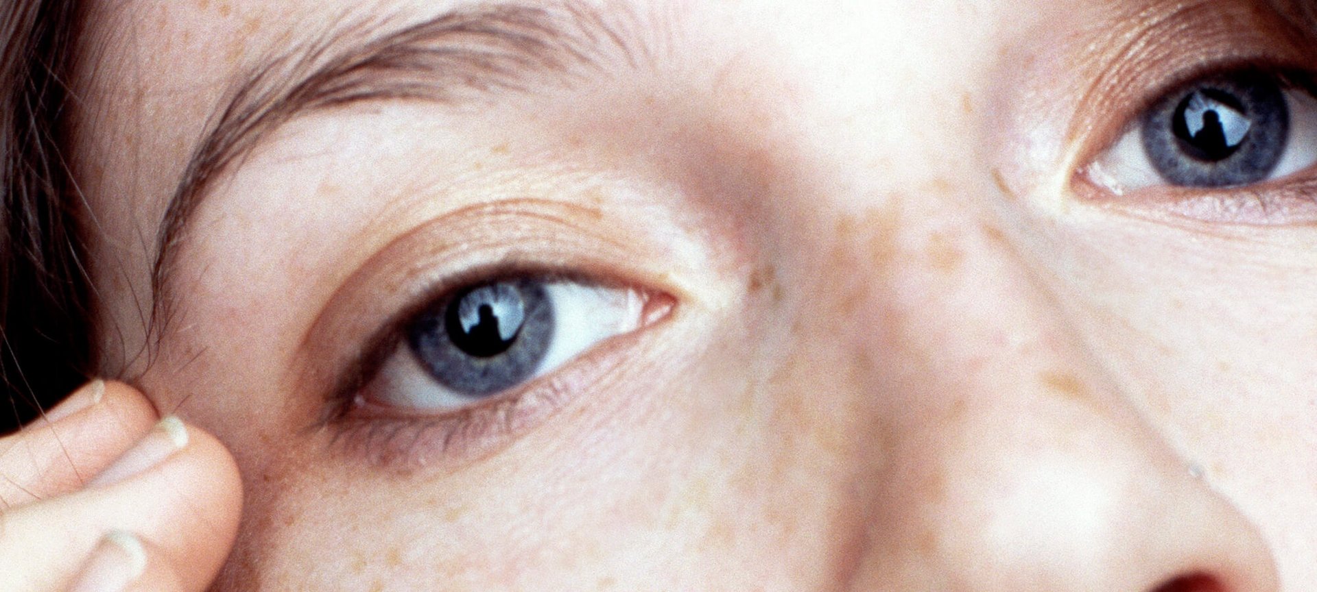 Acupresion En El Contorno De Los Ojos La Solucion Para Una Mirada Mas Joven