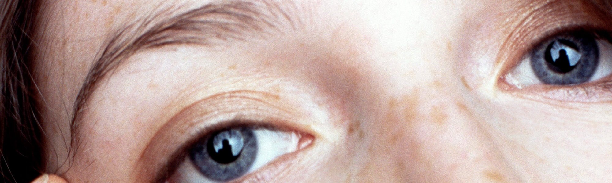 Acupresion En El Contorno De Los Ojos La Solucion Para Una Mirada Mas Joven