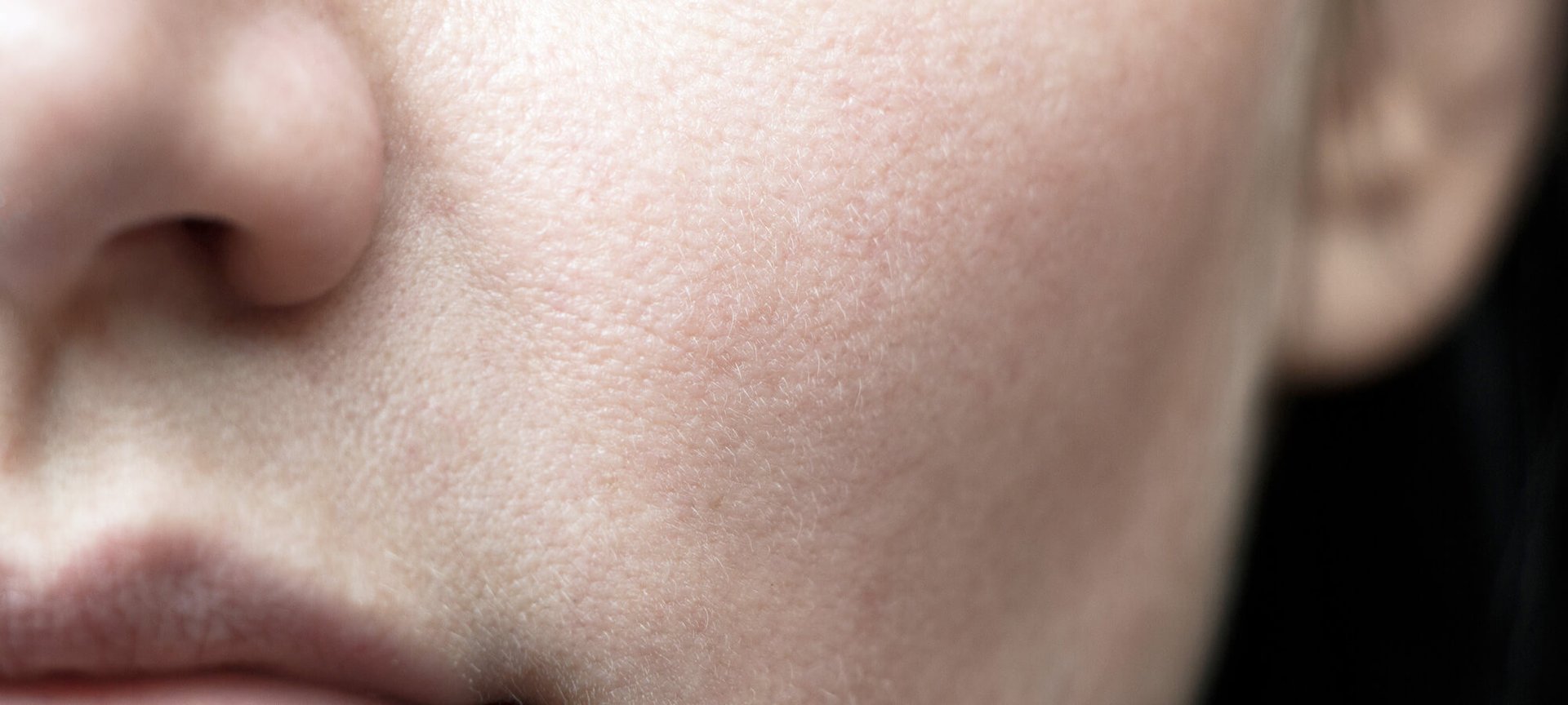 Los 5 Beneficios Del Acido Glicolico