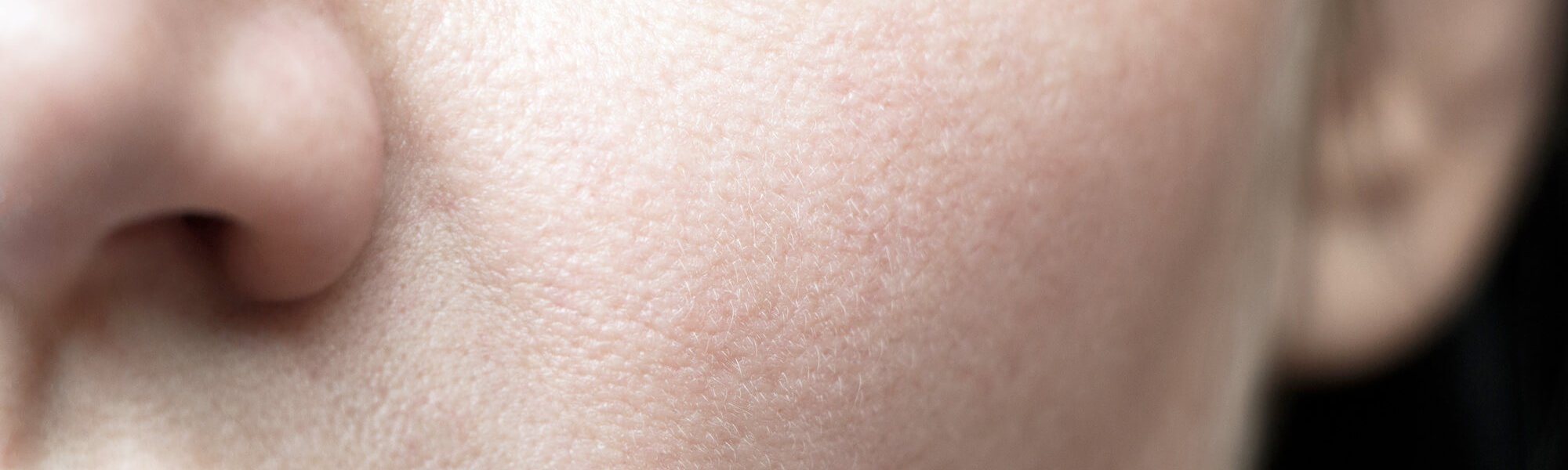 Los 5 Beneficios Del Acido Glicolico