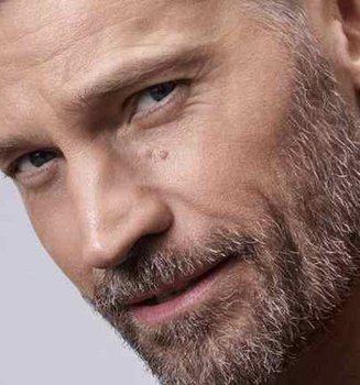 Por qué salen manchas en la cara en hombres y cómo evitar su aparición | L'Oréal Paris