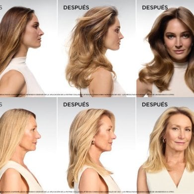 Antes Y Despus