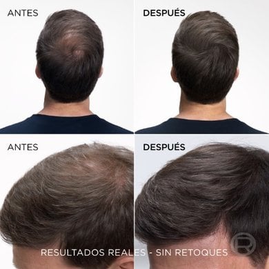 Magic Retouchba