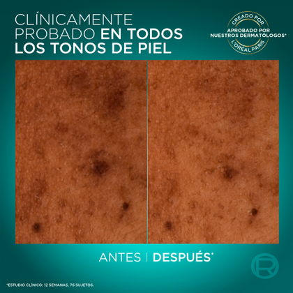 Oapskincarebrightrevealba20243600524122676PDP2400x2400ES Personalizado