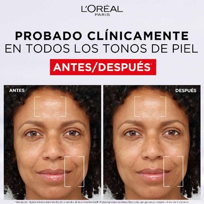 Gel Crema Rellenador Revitalift Filler Con Cido Hialurnico 03