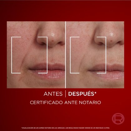 Revitalift Laser 3 Personalizado