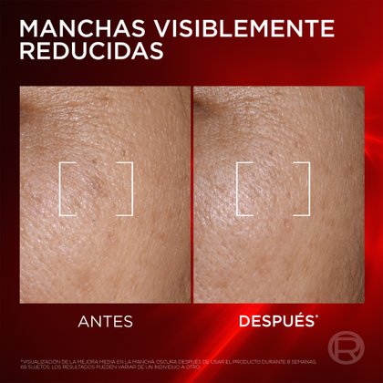 Manchas