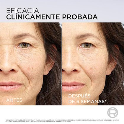 12 OAP Revitalift Hyaluronic Acid Pdrn Serum 2026 3600523873852 Before After ES 3000x3000px